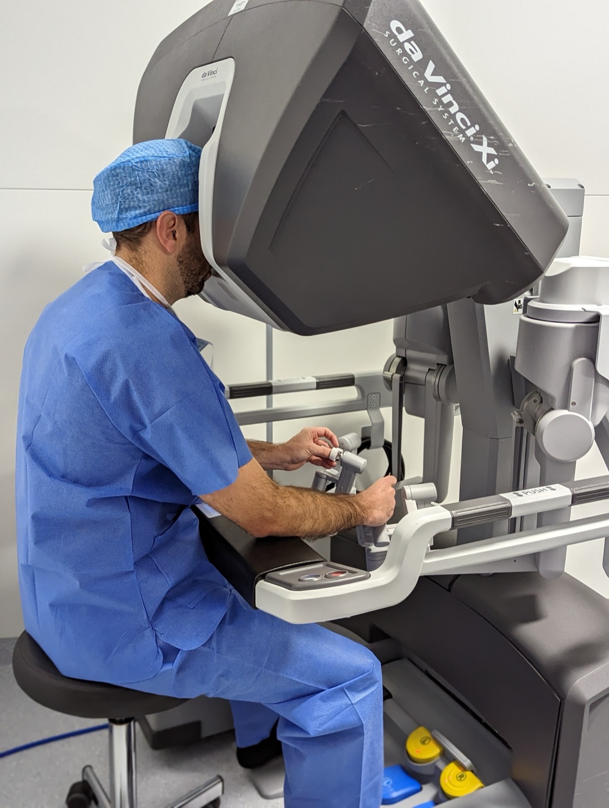 Dr. Alan Martínez Salas operando en la consola del robot da Vinci Xi - urólogo CDMX